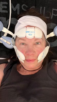 Emsculpt electronic lifting!