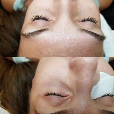 Eyelash extensions