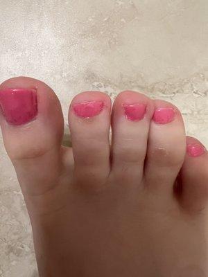 Terrible pedicure