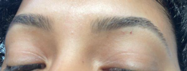 After Eyebrow Waxing