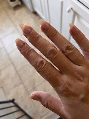 3 broken nails