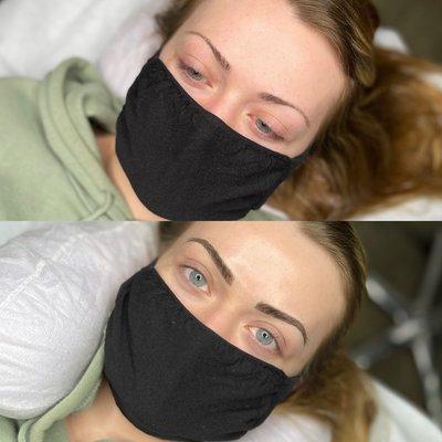 Microblading