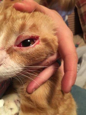 Blood coming out of the eye day after surgery