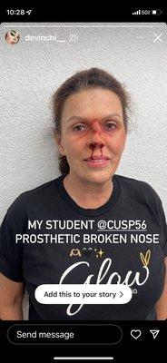 Prosthetics - Broken Nose