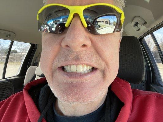 Post braces and cleaning. They are keeping me in good shape!