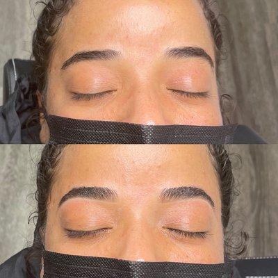 Brow shaping