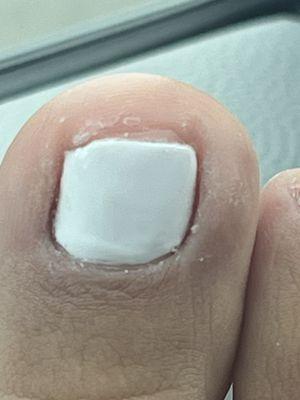 Result of how my pedicure turned out.