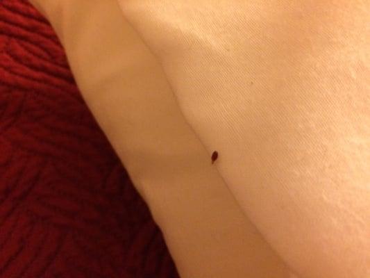 I just saw this crawling on my pillow this morning!!!!