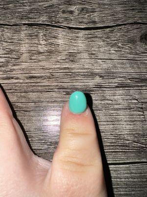 Uneven polish, cause sore in nail bed