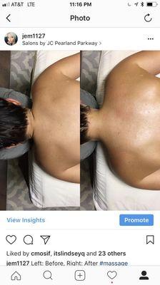 Before and after a deep tissue massage