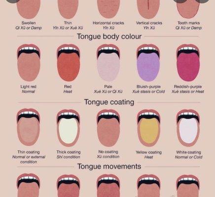 Tongue diagnosis