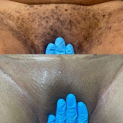 Brazilian Wax