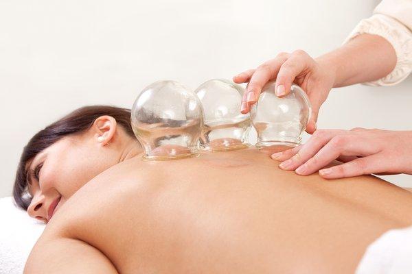 Fire cupping relaxes muscle tension and improves circulation. The cups can be placed at acupuncture points for individualized treatments.