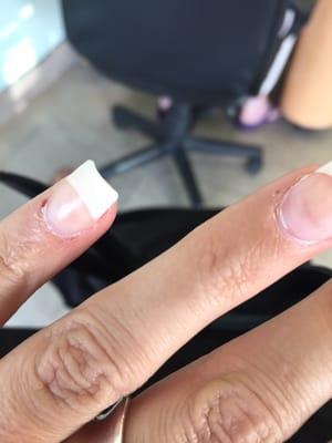 Cuticle cuts