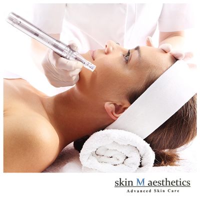 MicroNeedling with Stem Cell infusion