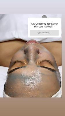 Acne Facial