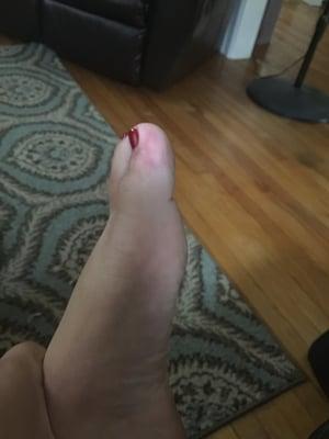 Nail polish all over my toe!