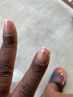 Weeks after the medication worked to rid my nails of fungus