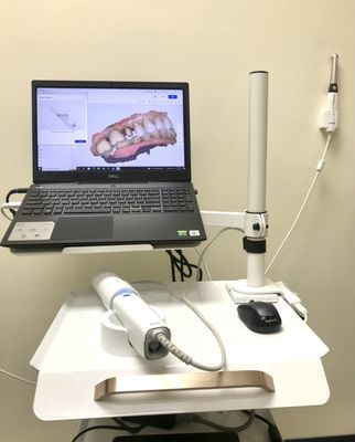 In office intraoral scanner for digital impressions of crowns, bridges and dental implants