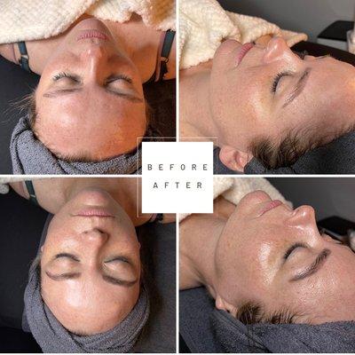 Dermaplane and brow tint