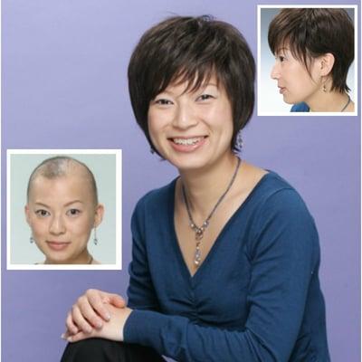 If you have hair loss due to medical treatments, such as chemo, we can also create modern hairstyles for you 由于治疗或个种原因而没头发，都可以通过织发造出各种时尚的发型