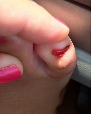 Don't mind my ugly little toe, but heres how they cut me at this place.