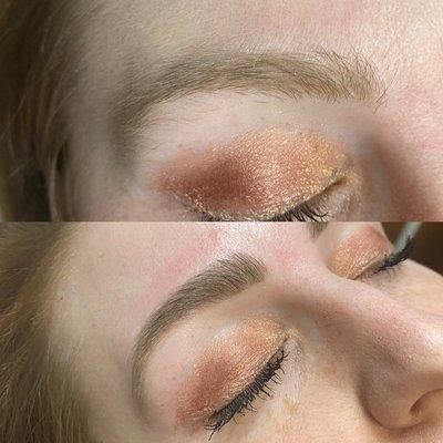 Brow Transformation