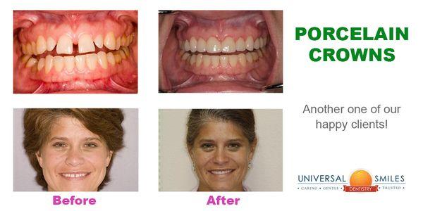 Universal Smiles Dentistry - Orlando