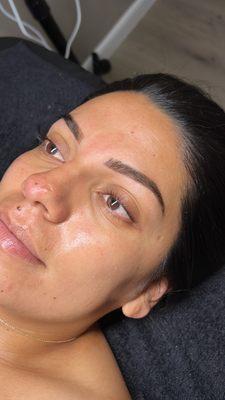 Lash lift + Dermaplaining facial