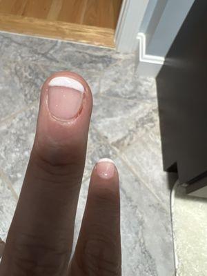 New found my beautiful finger is injured too