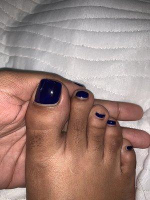 Gel toes