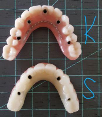 Front Range Dentures and Prosthodontics