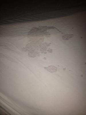 This was the sheet on the bed.. Further down there are two yellowish stains. Eew!