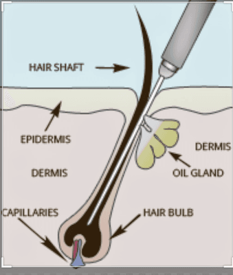 Electrolysis demo