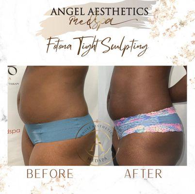 Angel Aesthetics Med spa