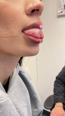 Tongue piercing