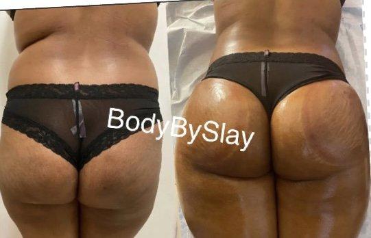 OMG Slay Look At Her Butt  Deluxe Package / Waist line Reduction