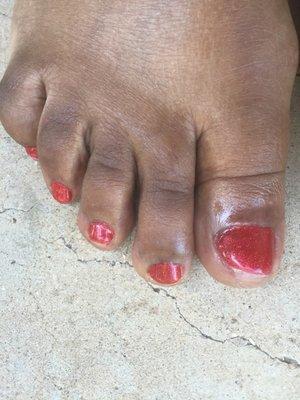 My toenails were rectangular, she removed my whole inside corner....both big toes!!!