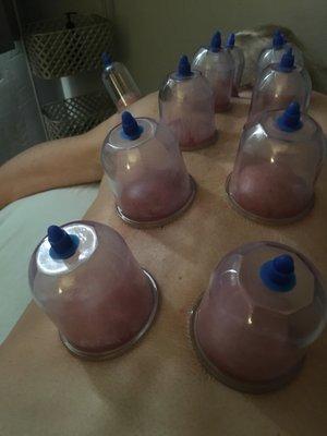 Cupping therapy- awwww my new favorite! Pulls all the stagnant lymph to the surface to be cleared out by the circulatory system!