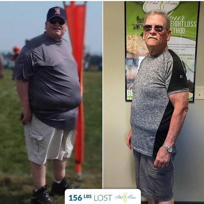 156 lb Weight Loss