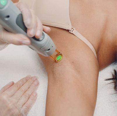 Laser Hair Removal w/ Cryo