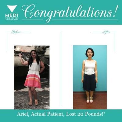 Congratulations! Ariel lost 20 pounds with the help of Medi-Weightloss Austin Clinic. Way to go, Ariel!