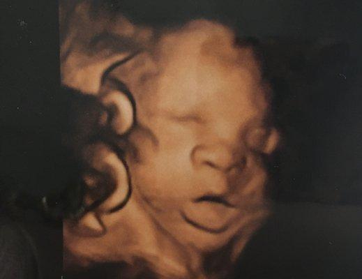 3D image of baby around 6/7 months