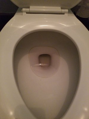 Ring in the toilet