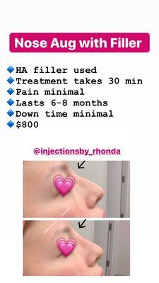 Rhonda Policandriotes RN BSN CANS  Instagram @injectionsby_rhonda  Facebook Rhonda Policandriotes  #lipfillers #lipinjections #botox