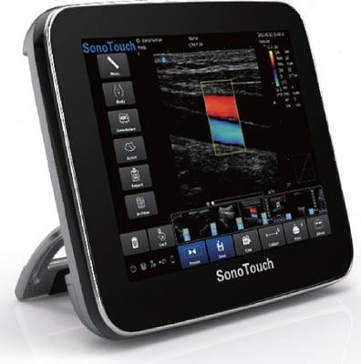 Chison Sonotouch Color 30