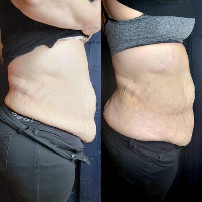 Look at her amazing results after 5 sessions.