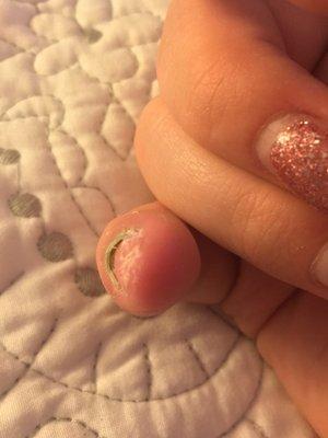 They used a dirty electric file and dug too deep into my nail bed. Now my nail has fallen off and my cuticle is green.