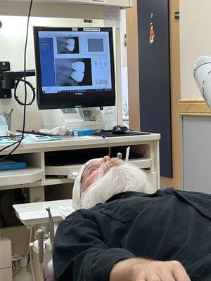 My husband with his new crowns! He is SO delighted with this dentist. So happy