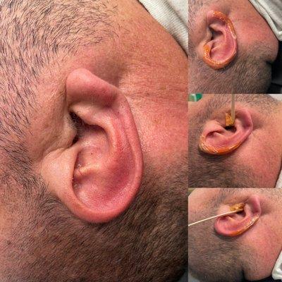 Men's ear wax before & during